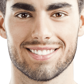 Dental Bonding Contouring